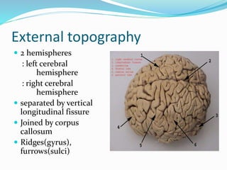 Cerebral Hemisphere Diagram