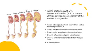• In 30% of children with UTI,
vesicoureteric refl ux (VUR) is present.
VUR is a developmental anomaly of the
vesicoureteric junction.
• There is often a positive family history. There are five
described grades of VUR.
• Grade I: reflux without dilatation into distal ureter
• Grade II: reflux with dilatation into proximal ureter
• Grade III: reflux into renal pelvis with dilatation
• Grade IV: further dilatation and distortion of calyces
Grade
• V: hydronephrosis
 