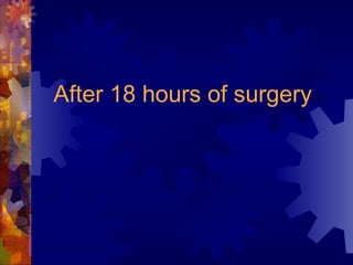 After 18 hours of surgery 