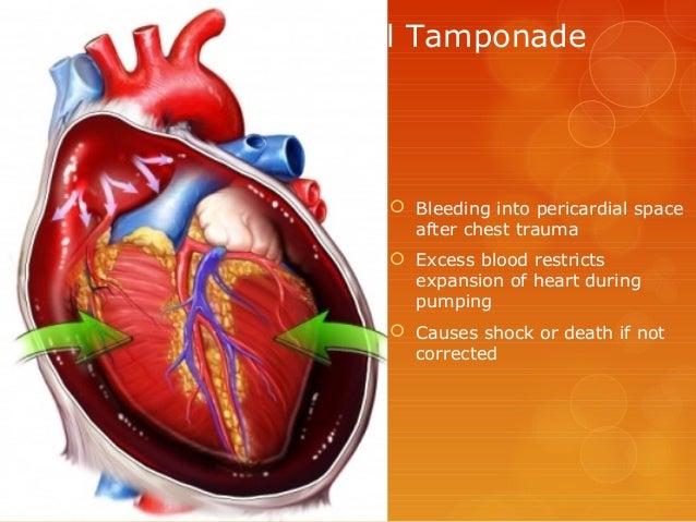 The circulatory system complete Info ppt