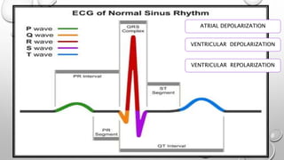 ATRIAL DEPOLARIZATION
VENTRICULAR DEPOLARIZATION
VENTRICULAR REPOLARIZATION
 