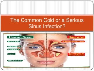 The Common Cold or a Serious
Sinus Infection?
 