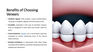 Benefits of Choosing
Veneers
• Aesthetic Appeal: They provide a quick transformation,
resulting in a brighter, aligned, and harmonious smile.
• Durability: Especially in the case of porcelain veneers,
they are designed to resist stains and remain intact for
years.
• Conservativeness: Veneers are a conservative approach
compared to crowns, preserving more of the natural
tooth structure.
• Boosted Confidence: A rejuvenated smile often brings
increased self-confidence, positively impacting social and
professional interactions.
 
