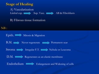 Stage of HealingStage of Healing
A) Vascularization
Limbal cap. Sup. Vasc. AB & Fibroblasts
B) Fibrous tissue formation
NB :NB :
Epith. Mitosis & Migration
B.M. Never regenerate Permanent scar
Stroma Irregular F.T. Nebula or Leucoma
D.M. Regenerates as an elastic membrane
Endothelium Enlargement and Widening of cells
 