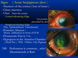 Signs ( Acute Serpiginous ulcer )
- Haziness of the cornea ( loss of luster )
- Ciliary injection
- Ulcer Near the centre
Central advancing Edge
Crescentic, undermined,
preceded by dense infiltration
Peripheral Healing Edge
Flat, Epithelialized, Vascularized
- Posterior Abscess :
Dense infiltration in front of D M
- Flourescein Test is +ve
- Hypopyon in the Anterior Chamber
( Steril Pus ) PNL +Fibrin +Iris Pigment
NB Perforation is common…why?
Desematocele is Rare
 