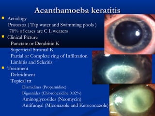 Acanthamoeba keratitisAcanthamoeba keratitis
 Aetiology
Protozoa ( Tap water and Swimming pools )
70% of cases are C L wearers
 Clinical Picture
Punctate or Dendritic K
Superficial Stromal K
Partial or Complete ring of Infiltration
Limbitis and Scleritis
 Treatment
Debridment
Topical ttt
Diamidines (Propamidine)
Biguanides (Chlorohexidine 0.02%)
Aminoglycosides (Neomycin)
Antifungal (Miconazole and Ketoconazole)
 