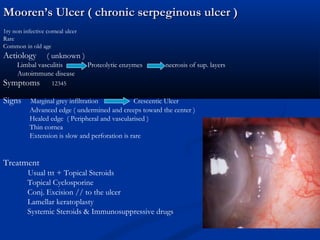 Mooren’s Ulcer ( chronic serpeginous ulcer )Mooren’s Ulcer ( chronic serpeginous ulcer )
1ry non infective corneal ulcer
Rare
Common in old age
Aetiology ( unknown )
Limbal vasculitis Proteolytic enzymes necrosis of sup. layers
Autoimmune disease
Symptoms 12345
Signs Marginal grey infiltration Crescentic Ulcer
Advanced edge ( undermined and creeps toward the center )
Healed edge ( Peripheral and vascularised )
Thin cornea
Extension is slow and perforation is rare
Treatment
Usual ttt + Topical Steroids
Topical Cyclosporine
Conj. Excision // to the ulcer
Lamellar keratoplasty
Systemic Steroids & Immunosuppressive drugs
 