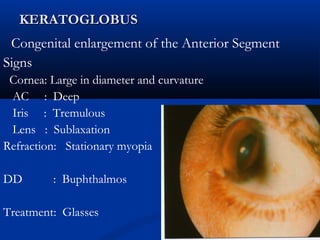 KERATOGLOBUSKERATOGLOBUS
Congenital enlargement of the Anterior Segment
Signs
Cornea: Large in diameter and curvature
AC : Deep
Iris : Tremulous
Lens : Sublaxation
Refraction: Stationary myopia
DD : Buphthalmos
Treatment: Glasses
 