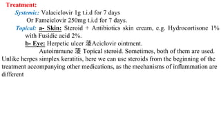 Treatment:
 Systemic: Valaciclovir 1g t.i.d for 7 days
Or Famciclovir 250mg t.i.d for 7 days.
 Topical: a- Skin: Steroid + Antibiotics skin cream, e.g. Hydrocortisone 1%
with Fusidic acid 2%.
b- Eye: Herpetic ulcer Aciclovir ointment.
Autoimmune  Topical steroid. Sometimes, both of them are used.
Unlike herpes simplex keratitis, here we can use steroids from the beginning of the
treatment accompanying other medications, as the mechanisms of inflammation are
different
 