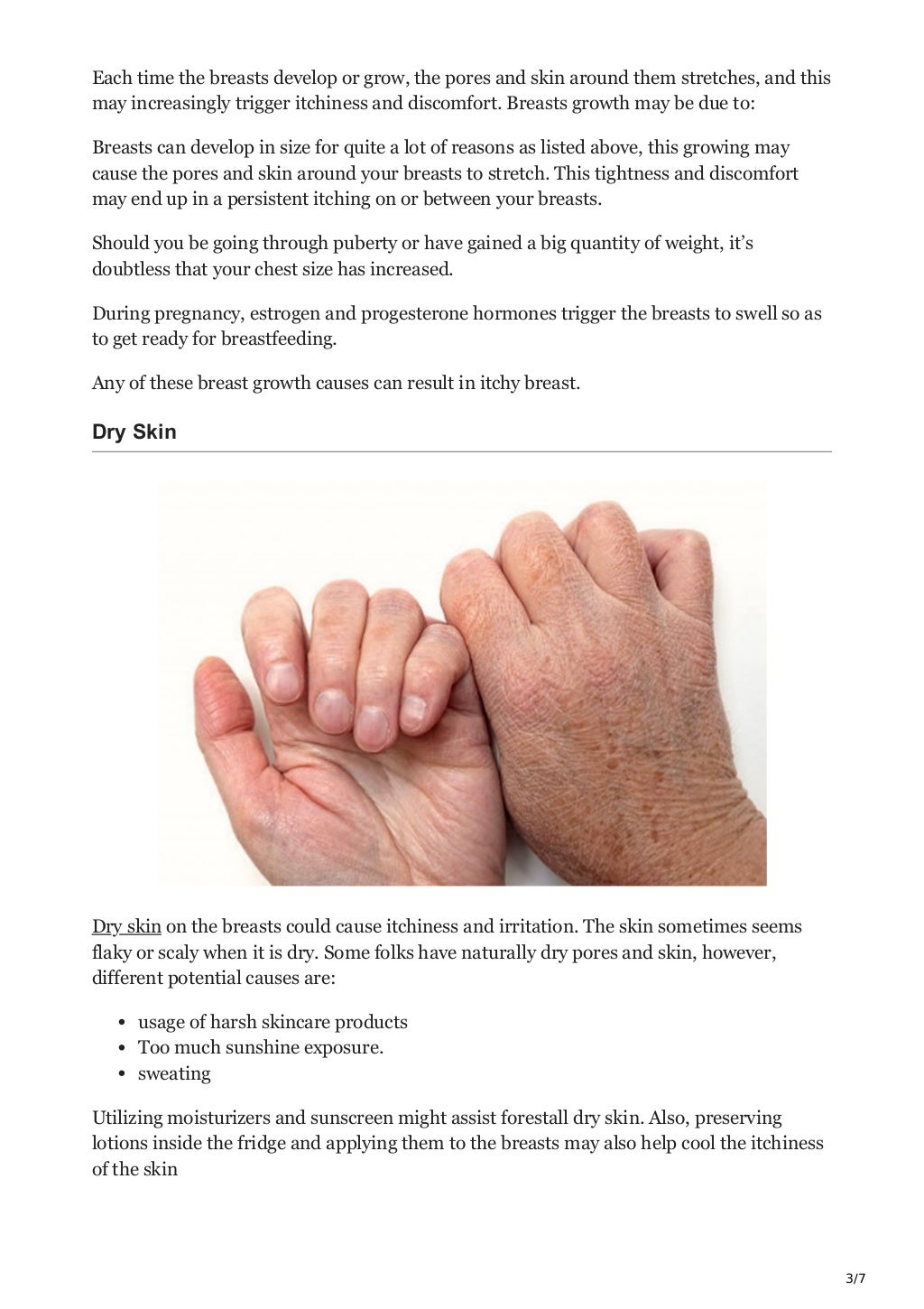 itchy breast no rash 5 simple causes and treatment