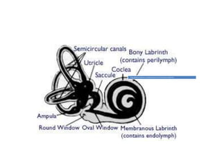 Bing siebman dysplasia-complete abscence of membranous labyrinth