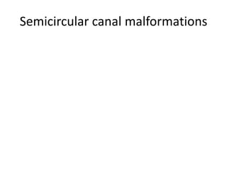 Semicircular canal malformations