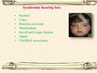 Syndromic hearing loss
• Pendred
• Usher
• Branchio-oto-renal
• Waardenburg
• Jervell and Lange-Nielsen
• Alport
• CHARGE association
 