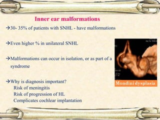 Inner ear malformations
30- 35% of patients with SNHL - have malformations
Even higher % in unilateral SNHL
Malformations can occur in isolation, or as part of a
syndrome
Why is diagnosis important?
Risk of meningitis
Risk of progression of HL
Complicates cochlear implantation
 