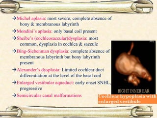 Michel aplasia: most severe, complete absence of
bony & membranous labyrinth
Mondini’s aplasia: only basal coil present
Sheibe’s (cochleosaccular)dysplasia: most
common, dysplasia in cochlea & saccule
Bing-Siebenman dysplasia: complete absence of
membranous labyrinth but bony labyrinth
present
Alexander’s dysplasia: Limited cochlear duct
differentiation at the level of the basal coil
Enlarged vestibular aqueduct: early onset SNHL,
progressive
Semicircular canal malformations
 