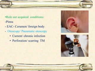 •Rule out acquired conditions:
-Pinna
- EAC- Cerumen/ foreign body
- Otoscopy/ Pneumatic otoscopy
• Current/ chronic infection
• Perforation/ scarring TM
 