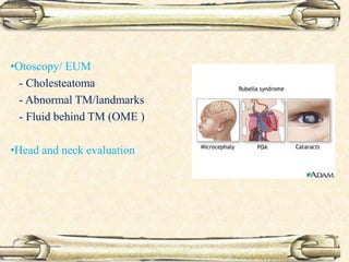 •Otoscopy/ EUM
- Cholesteatoma
- Abnormal TM/landmarks
- Fluid behind TM (OME )
•Head and neck evaluation
 