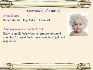 Arousal test:
Sound stimuli light sleep arousal
Auditory response cradle(ARC):
Baby in cradle-behaviour in response to sound
stimulustrunk & limb movement, head jerk and
respiration
Assessment of hearing
 