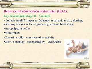 Behavioural observation audiometry (BOA):
Key developmental age: 0 – 6 months
• Sound stimuli response change in behaviour e.g., alerting,
widening of eyes or facial grimacing, arousal from sleep
•Auropalpebral reflex
•Moro reflex:
•Cessation reflex: cessation of an activity
•Use < 6 months – superseded by – OAE,ABR
 