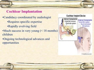 Cochlear Implantation
•Candidacy coordinated by audiologist
•Requires specific expertise
•Rapidly evolving field
•Much success in very young (< 18 months)
children
•Ongoing technological advances and
opportunities
 
