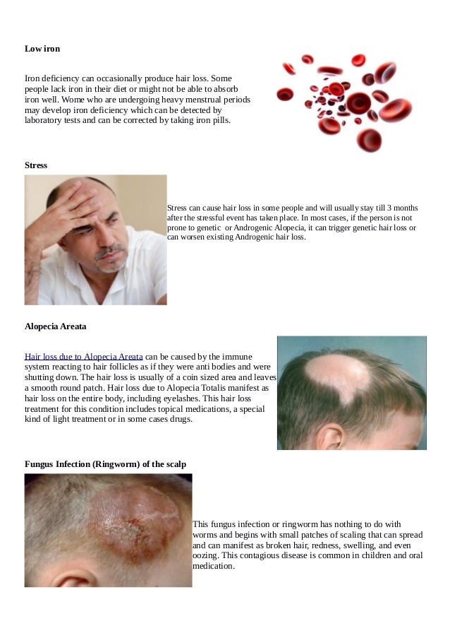 The Deeper Causes Of Hair Loss By Disease & Lifestyle