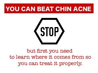but first you need
to learn where it comes from so
you can treat it properly.
YOU CAN BEAT CHIN ACNE
 