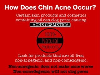 How Does Chin Acne Occur?
Certain skin products and cosmetics
containing oil can clog pores causing
ACNE COSMETICA.
Look for products that are oil-free,
non-acnegenic, and non-comedogenic.
Non-acnegenic: does not make acne worse
Non-comedogenic: will not clog pores
 