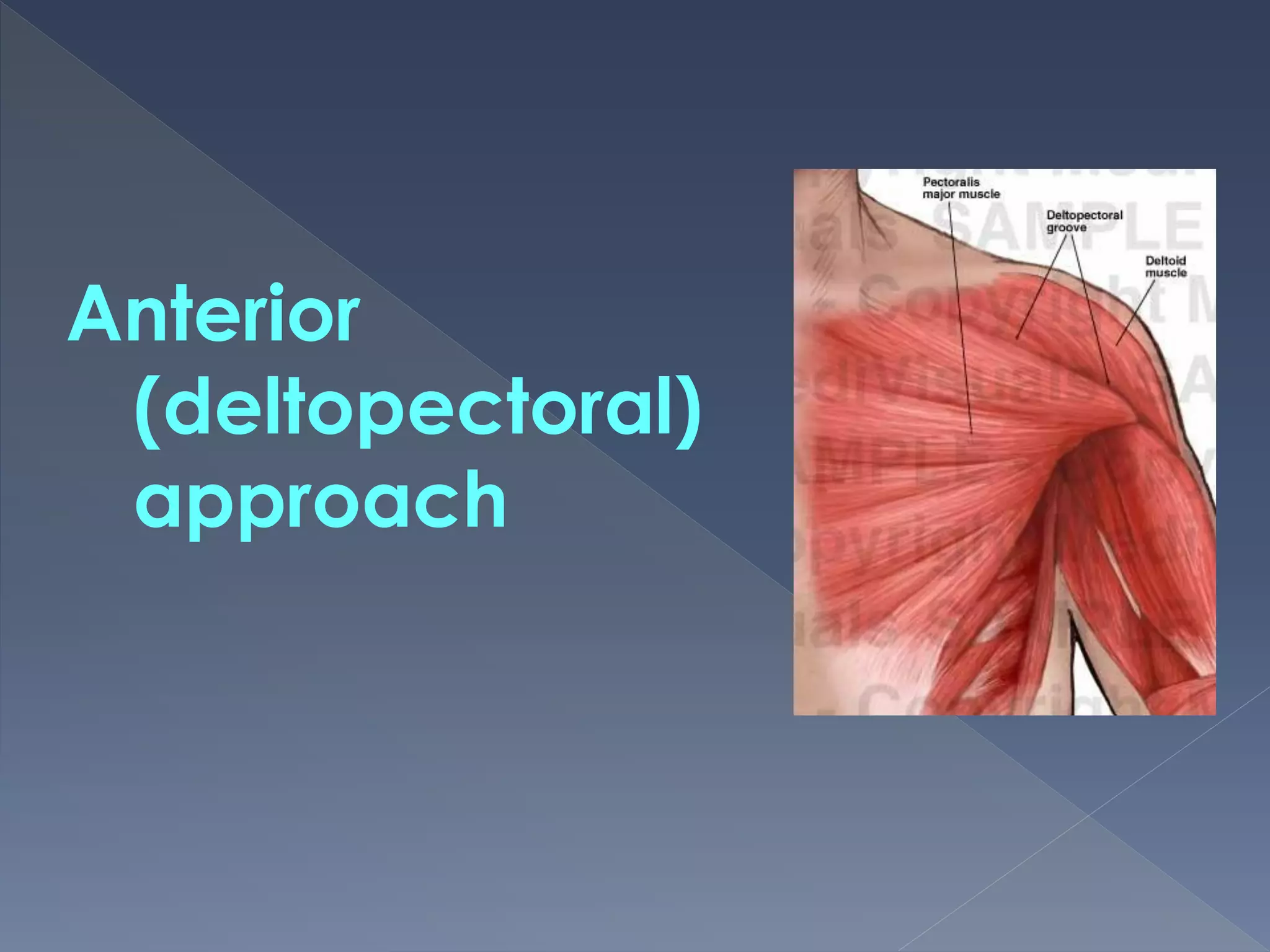 The deltopectoral approach PPT