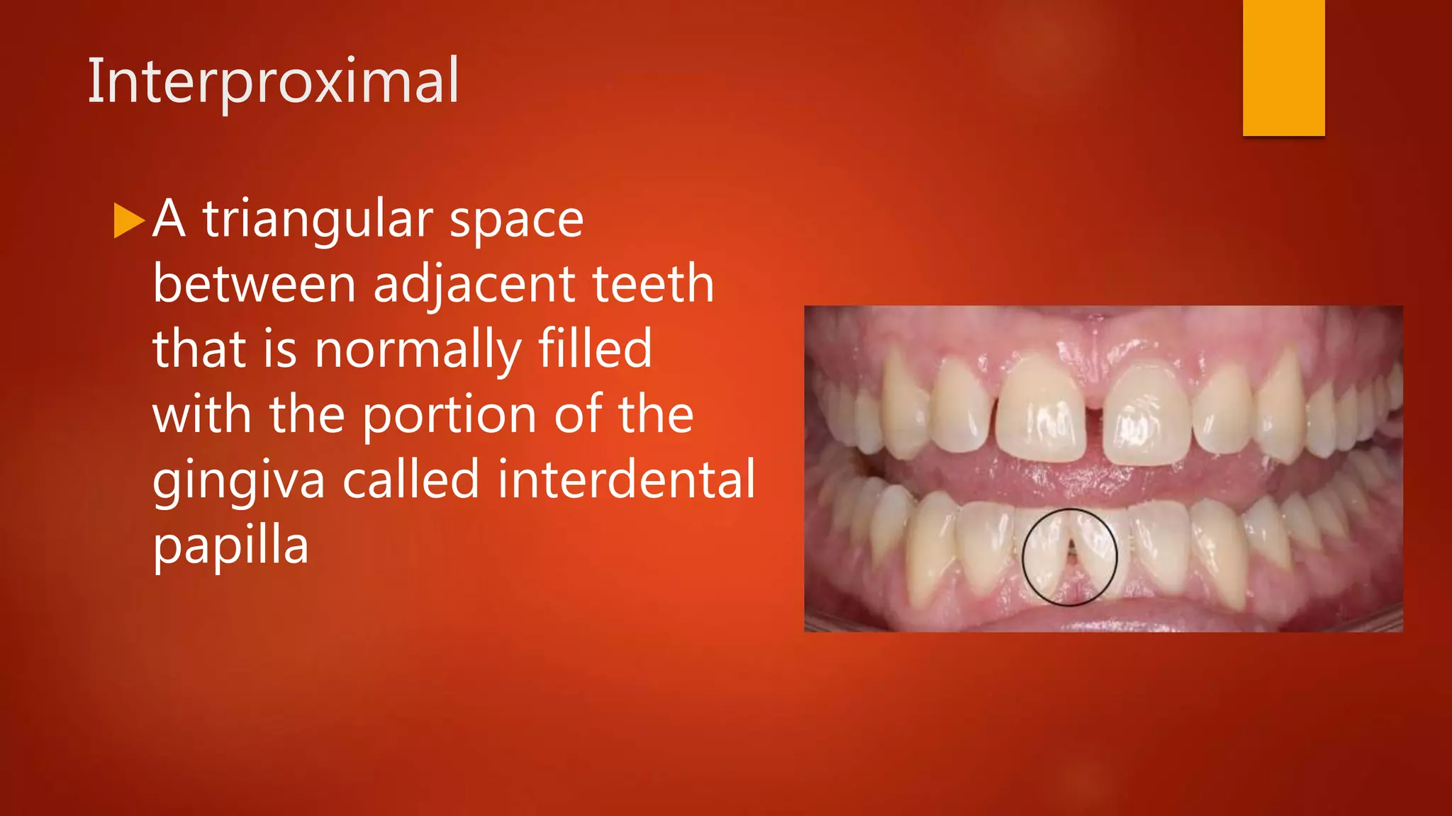Interproximal
A triangular space
between adjacent teeth
that is normally filled
with the portion of the
gingiva called interdental
papilla
 