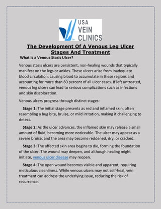 The Development Of A Venous Leg Ulcer
Stages And Treatment
What Is a Venous Stasis Ulcer?
Venous stasis ulcers are persistent, non-healing wounds that typically
manifest on the legs or ankles. These ulcers arise from inadequate
blood circulation, causing blood to accumulate in these regions and
accounting for more than 80 percent of all ulcer cases. If left untreated,
venous leg ulcers can lead to serious complications such as infections
and skin discoloration.
Venous ulcers progress through distinct stages:
Stage 1: The initial stage presents as red and inflamed skin, often
resembling a bug bite, bruise, or mild irritation, making it challenging to
detect.
Stage 2: As the ulcer advances, the inflamed skin may release a small
amount of fluid, becoming more noticeable. The ulcer may appear as a
severe bruise, and the area may become reddened, dry, or cracked.
Stage 3: The affected skin area begins to die, forming the foundation
of the ulcer. The wound may deepen, and although healing might
initiate, venous ulcer disease may reopen.
Stage 4: The open wound becomes visible and apparent, requiring
meticulous cleanliness. While venous ulcers may not self-heal, vein
treatment can address the underlying issue, reducing the risk of
recurrence.
 