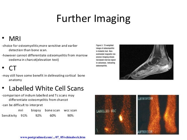 The diabetic foot - Derek Park