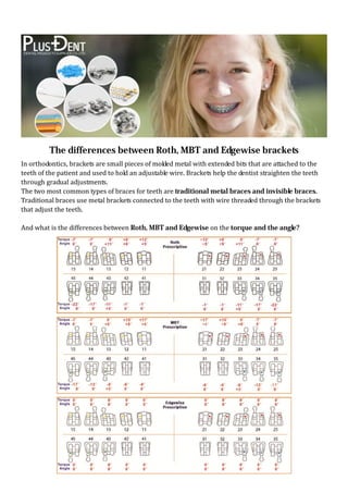 The differences between Roth, MBT and Edgewise brackets
In orthodontics, brackets are small pieces of molded metal with extended bits that are attached to the
teeth of the patient and used to hold an adjustable wire. Brackets help the dentist straighten the teeth
through gradual adjustments.
The two most common types of braces for teeth are traditional metal braces and invisible braces.
Traditional braces use metal brackets connected to the teeth with wire threaded through the brackets
that adjust the teeth.
And what is the differences between Roth, MBT and Edgewise on the torque and the angle?
 