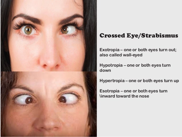 The Different Types Of Vision Problems The Different Types Of Vision Problems