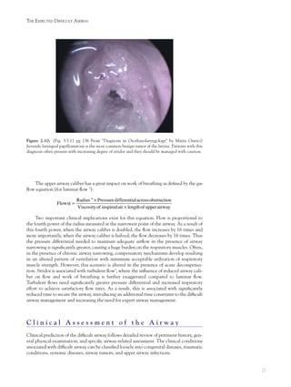 21
THE EXPECTED DIFFICULT AIRWAY
The upper airway caliber has a great impact on work of breathing as deﬁned by the gas
ﬂow equation (for laminar ﬂow 3
):
α
×
=
×
4
Radius Pressuredifferentialacrossobstruction
Flow
Viscosityof inspiredair lengthof upperairway
Two important clinical implications exist for this equation. Flow is proportional to
the fourth power of the radius measured at the narrowest point of the airway. As a result of
this fourth power, when the airway caliber is doubled, the ﬂow increases by 16 times and
more importantly, when the airway caliber is halved, the ﬂow decreases by 16 times. Thus
the pressure differential needed to maintain adequate airﬂow in the presence of airway
narrowing is signiﬁcantly greater, causing a huge burden on the respiratory muscles. Often,
in the presence of chronic airway narrowing, compensatory mechanisms develop resulting
in an altered pattern of ventilation with minimum acceptable utilization of respiratory
muscle strength. However, this scenario is altered in the presence of acute decompensa-
tion. Stridor is associated with turbulent ﬂow3
, where the inﬂuence of reduced airway cali-
ber on ﬂow and work of breathing is further exaggerated compared to laminar ﬂow.
Turbulent ﬂows need signiﬁcantly greater pressure differential and increased respiratory
effort to achieve satisfactory ﬂow rates. As a result, this is associated with signiﬁcantly
reduced time to secure the airway, introducing an additional time constraint to the difﬁcult
airway management and increasing the need for expert airway management.
C l i n i c a l A s s e s s m e n t o f t h e A i r w a y
Clinical prediction of the difﬁcult airway follows detailed review of pertinent history, gen-
eral physical examination, and speciﬁc airway-related assessment. The clinical conditions
associated with difﬁcult airway can be classiﬁed loosely into congenital diseases, traumatic
conditions, systemic diseases, airway tumors, and upper airway infections.
Figure 2.10. (Fig. 3.5.11 pg 136 From "Diagnosis in Otorhinolaryngology" by Matin Onerci)
Juvenile laryngeal papillomatosis is the most common benign tumor of the larynx. Patients with this
diagnosis often present with increasing degree of stridor and they should be managed with caution.
 