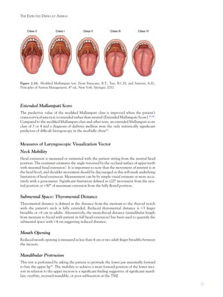 27
THE EXPECTED DIFFICULT AIRWAY
Extended Mallampati Score
The predictive value of the modiﬁed Mallampati class is improved when the patient’s
craniocervical junction is extended rather than neutral (Extended Mallampati Score) 43, 44
.
Compared to the modiﬁed Mallampati class and other tests, an extended Mallampati score
class of 3 or 4 and a diagnosis of diabetes mellitus were the only statistically signiﬁcant
predictors of difﬁcult laryngoscopy in the morbidly obese43
.
Measures of Laryngoscopic Visualization Vector
Neck Mobility
Head extension is measured or estimated with the patient sitting from the neutral head
position. The examiner estimates the angle traversed by the occlusal surface of upper teeth
with maximal head extension5
. It is important to note that the movement of interest is at
the head level, and shoulder movement should be discouraged as this will mask underlying
limitation of head extension. Measurement can be by simple visual estimate or more accu-
rately with a goniometer. Signiﬁcant limitation deﬁned as £20° movement from the neu-
tral position or <80° of maximum extension from the fully ﬂexed position.
Submental Space: Thyromental Distance
Thyromental distance is deﬁned as the distance from the mentum to the thyroid notch
with the patient’s neck is fully extended. Reduced thyromental distance is <3 ﬁnger
breadths or <6 cm in adults. Alternatively, the mentohyoid distance (mandibular length
from mentum to hyoid with patient in full head extension) has been used to quantify the
submental space with <4 cm suggesting reduced distance.
Mouth Opening
Reduced mouth opening is measured as less than 4 cm or two adult ﬁnger breadths between
the incisors.
Mandibular Protrusion
This test is performed by asking the patient to protrude the lower jaw maximally forward
to bite the upper lip45
. The inability to achieve a more forward position of the lower inci-
sors in relation to the upper incisors is a signiﬁcant ﬁnding suggestive of signiﬁcant maxil-
lary overbite, recessed mandible, or poor subluxation at the TMJ.
Figure 2.16. Modiﬁed Mallampati test. From Finucane, B.T., Tsui, B.C.H, and Santora, A.H.,
Principles of Airway Management, 4th
ed., New York: Springer, 2010.
 