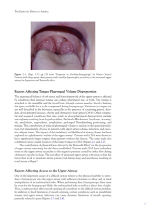 13
THE EXPECTED DIFFICULT AIRWAY
Factors Affecting Tongue-Pharyngeal Volume Disproportion
The anatomical balance of soft tissue and bony framework of the upper airway is affected
by conditions that increase tongue size, reduce pharyngeal size, or both. The tongue is
attached to the mandible and the hyoid bone through various muscles, thereby limiting
the space available for it to be compressed during laryngoscopy. Variations in tongue size
are well described in the literature, especially in the presence of coexisting genetic disor-
ders, developmental diseases, obesity and obstructive sleep apnea (OSA). Other congeni-
tal and acquired conditions that may result in glossopharyngeal disproportion include
macroglossia resulting from hypothyroidism, Beckwith-Wiedemann Syndrome, acromeg-
aly, amyloidosis, angioedema, anaphylaxis, prolonged Trendelenburg positioning, and
trauma. The contribution of reduced pharyngeal volume is unclear in the general popula-
tion, but immediately obvious in patients with upper airway edema, infection, and exces-
sive adipose tissue. The impact of this imbalance on likelihood of airway closure has been
explored in cephalometric studies of the upper airway2
. Patients with OSA were shown to
have signiﬁcantly larger tongues than patients without the disease. The same study also
conﬁrmed a more caudal location of the larger tongue in OSA (Figures 2.1 and 2.2).
The contribution of physical forces driven by the Bernoulli Effect3
on the progression
of upper airway narrowing has also been established. Patients with OSA have redundant
tissue in the upper airway secondary to the negative pressure caused by oriﬁce ﬂow during
obstructive epochs in sleep. The net effect of increased upper airway soft tissue is that the
forces that work to maintain airway patency fail during sleep and anesthesia, resulting in
total airway collapse4
.
Factors Affecting Access to the Upper Airway
One of the important causes of a difﬁcult airway relates to the physical inability to intro-
duce a laryngoscope into the upper airway with sufﬁcient clearance to allow oral or nasal
manipulation of an endotracheal tube. When performing direct laryngoscopy, there must
be room for the laryngoscope blade, the endotracheal tube as well as a direct line of sight.
Thus, conditions that affect mouth opening all contribute to the difﬁcult airway problem.
In addition to ﬁxed limitation of mouth opening, certain conditions such as mandibular
trauma and upper airway infection can cause dynamic limitation of mouth opening,
primarily related to pain (Figures 2.3 and 2.4).
Figure 2.1. (Figs. 3.3.2 pg 129 from "Diagnosis in Otorhinolaryngology" by Matin Onerci)
Patients with sleep apnea often present with tonsillar hypertrophy secondary to the increased upper
airway fat deposition and Bernoulli effect.
 
