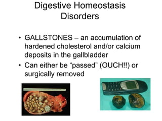 Digestive Homeostasis
Disorders
• GALLSTONES – an accumulation of
hardened cholesterol and/or calcium
deposits in the gallbladder
• Can either be “passed” (OUCH!!) or
surgically removed
 