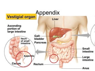 Appendix
Vestigial organVestigial organ
 