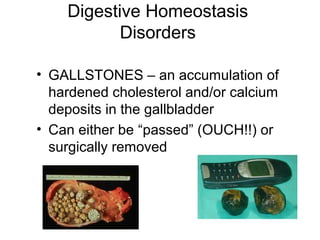 Digestive Homeostasis
Disorders
• GALLSTONES – an accumulation of
hardened cholesterol and/or calcium
deposits in the gallbladder
• Can either be “passed” (OUCH!!) or
surgically removed
 