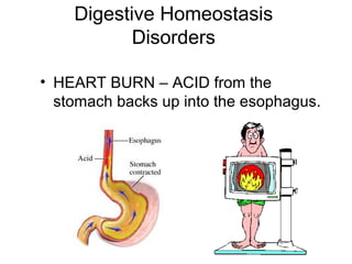 Digestive Homeostasis
Disorders
• HEART BURN – ACID from the
stomach backs up into the esophagus.
 