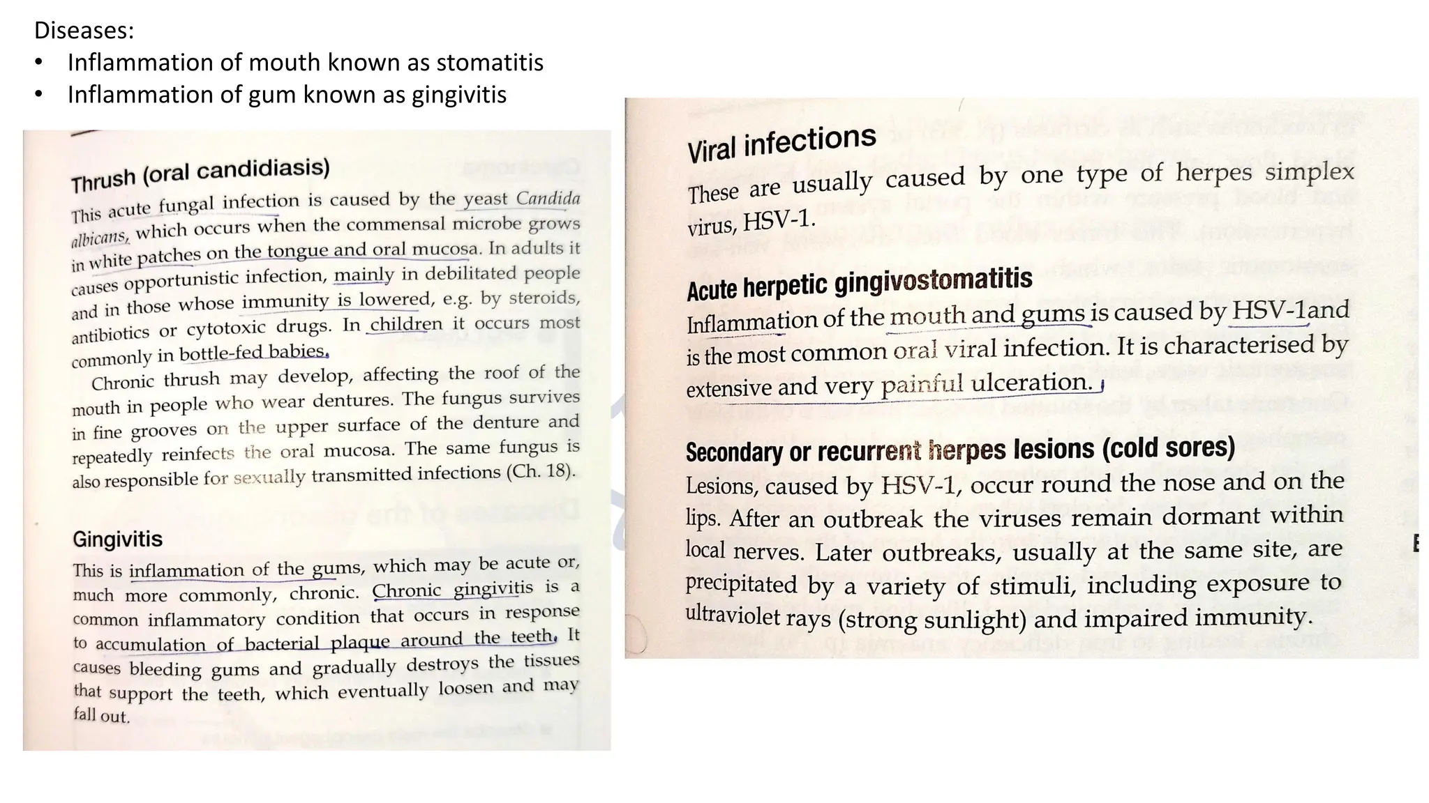 Diseases:
• Inflammation of mouth known as stomatitis
• Inflammation of gum known as gingivitis
 