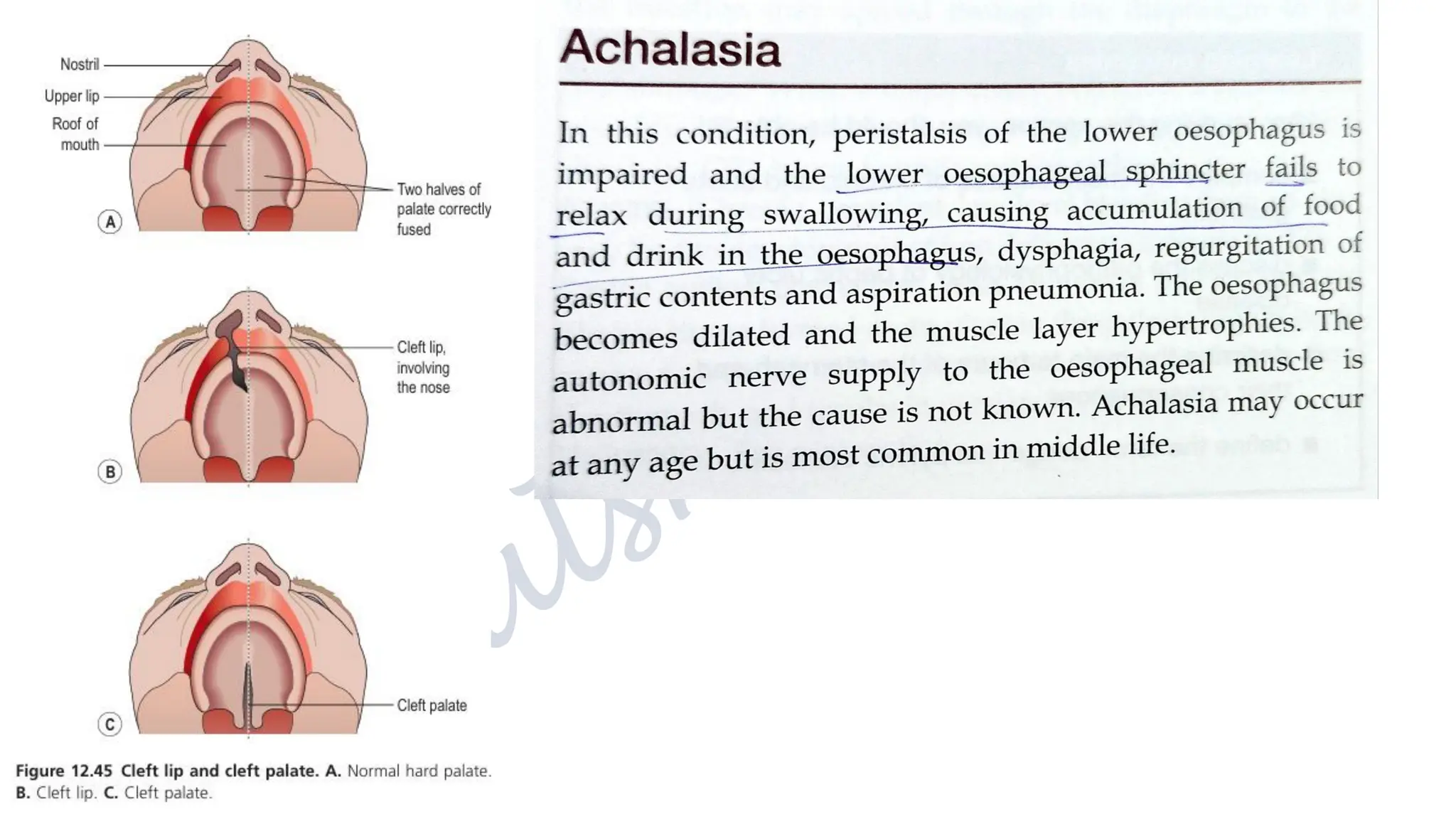 The digestive system, structure, functions and their disorders.pdf
