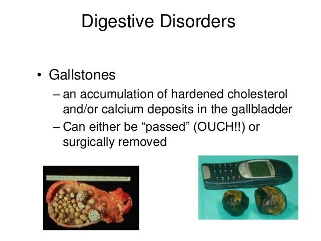 The digestivesystem and disorders