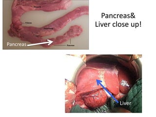 Pancreas & Liver close up!PancreasLiver