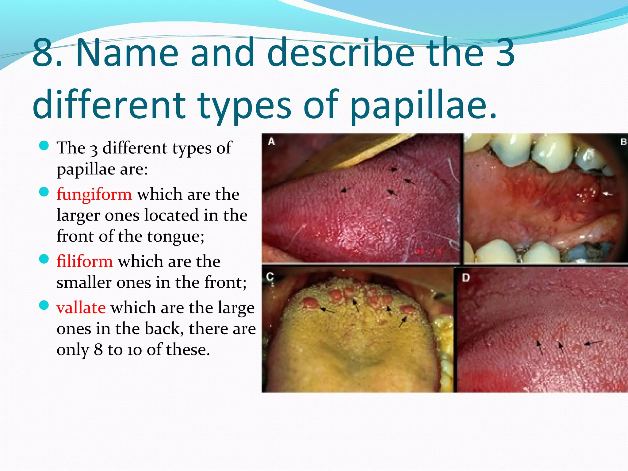 8. Name and describe the 3
different types of papillae.
The 3 different types of
papillae are:
fungiform which are the
larger ones located in the
front of the tongue;
filiform which are the
smaller ones in the front;
vallate which are the large
ones in the back, there are
only 8 to 10 of these.
 