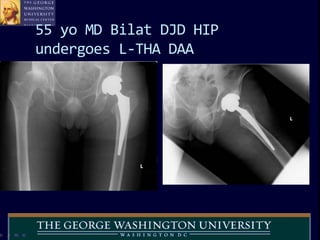 The Direct Anterior Hip Replacement | PPTX