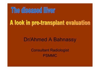 Dr/Ahmed A Bahnassy
Consultant Radiologist
PSMMC

 