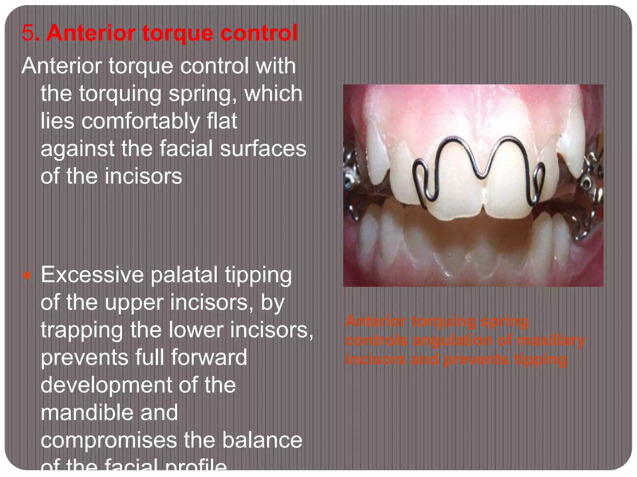 Anterior torquing spring
controls angulation of maxillary
incisors and prevents tipping
5. Anterior torque control
Anterior torque control with
the torquing spring, which
lies comfortably flat
against the facial surfaces
of the incisors
 Excessive palatal tipping
of the upper incisors, by
trapping the lower incisors,
prevents full forward
development of the
mandible and
compromises the balance
of the facial profile.
 