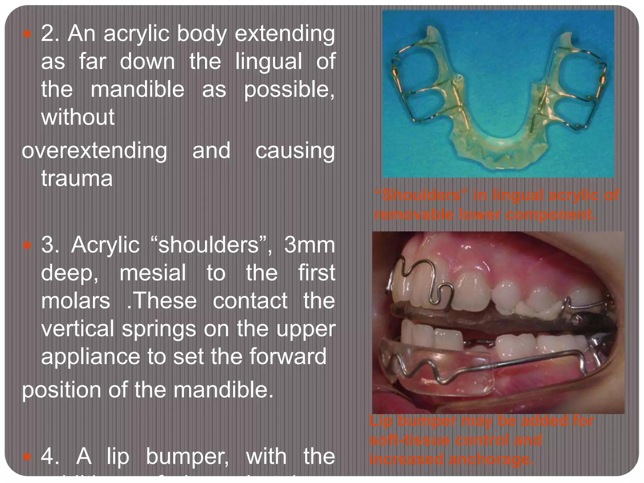 Lip bumper may be added for
soft-tissue control and
increased anchorage.
“Shoulders” in lingual acrylic of
removable lower component.
 2. An acrylic body extending
as far down the lingual of
the mandible as possible,
without
overextending and causing
trauma
 3. Acrylic “shoulders”, 3mm
deep, mesial to the first
molars .These contact the
vertical springs on the upper
appliance to set the forward
position of the mandible.
 4. A lip bumper, with the
 