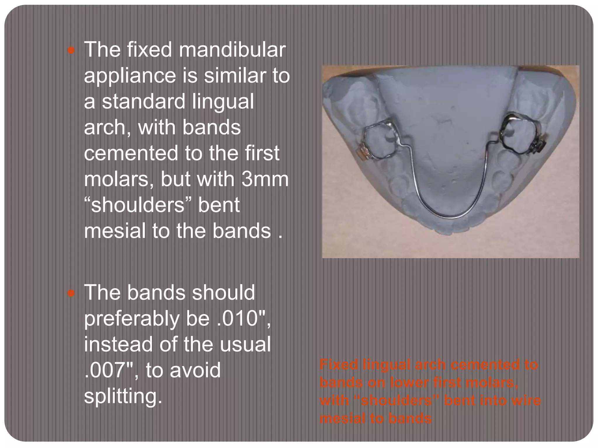 Fixed lingual arch cemented to
bands on lower first molars,
with “shoulders” bent into wire
mesial to bands
 The fixed mandibular
appliance is similar to
a standard lingual
arch, with bands
cemented to the first
molars, but with 3mm
“shoulders” bent
mesial to the bands .
 The bands should
preferably be .010",
instead of the usual
.007", to avoid
splitting.
 